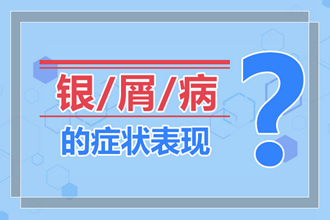 一些关于牛皮癣的谣言我们要知道避免