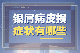 在医院一般如何确诊患者有没有患上牛皮癣